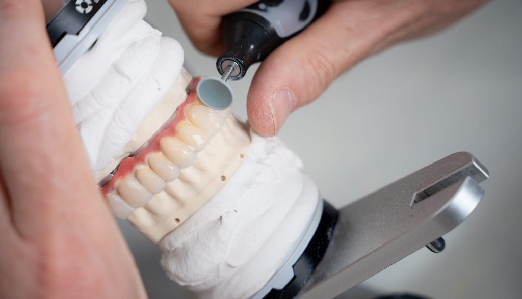 Zahntechniker schleift hochwertigen Zahnersatz im hauseigenen Dentallabor von Dr. Hennies in Göttingen