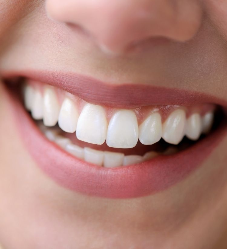 Nahaufnahme eines lächelnden Mundes mit schönen weißen Zähnen – ästhetische Zahnmedizin bei Dr. Hennies in Göttingen.