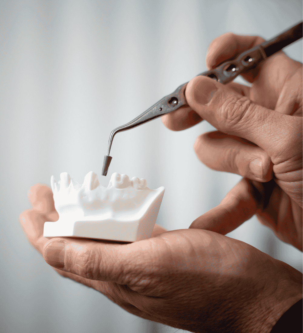 Zahnimplantat-Modell mit Instrument – moderne Implantologie bei Dr. Hennies in Göttingen