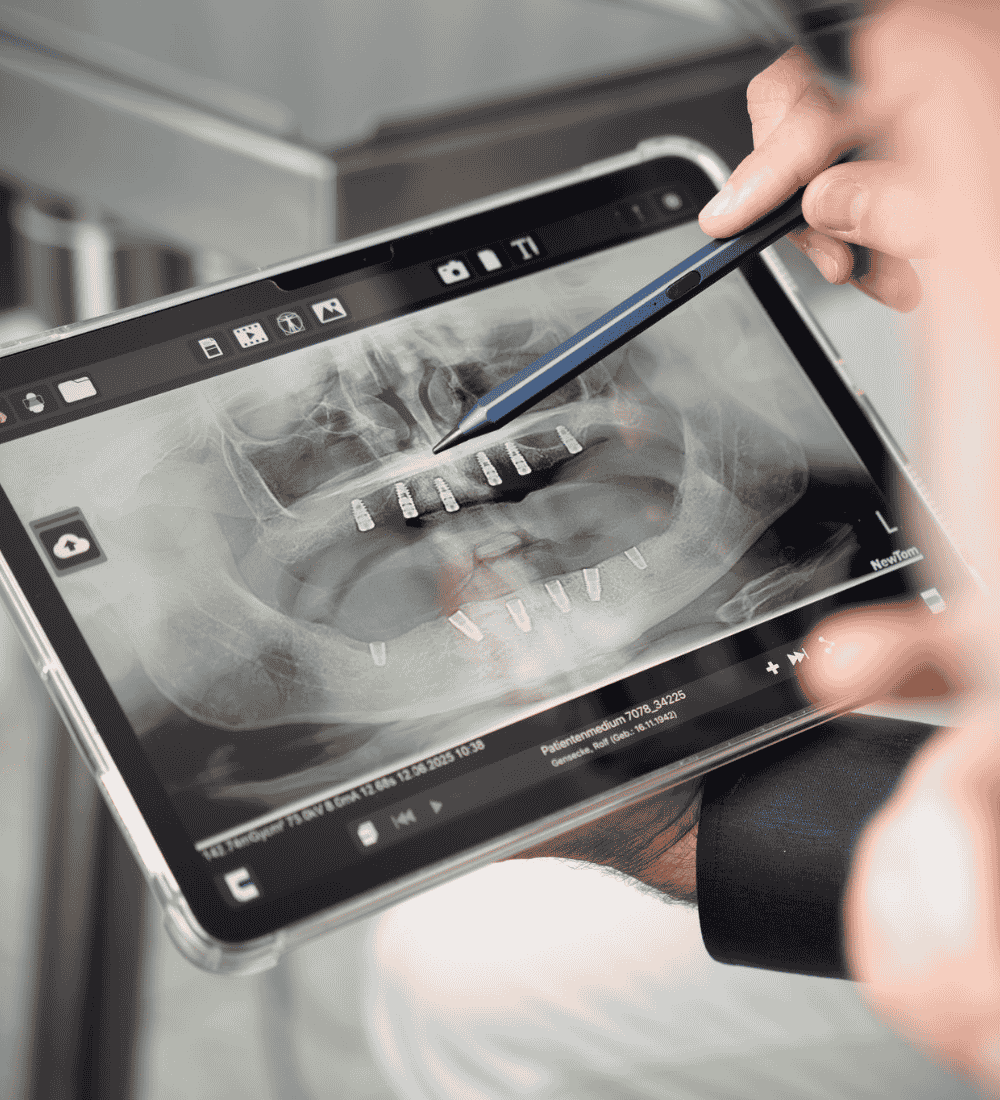 Digitale Implantatplanung auf dem Tablet – präzise 3D-Diagnostik bei Dr. Hennies in Göttingen